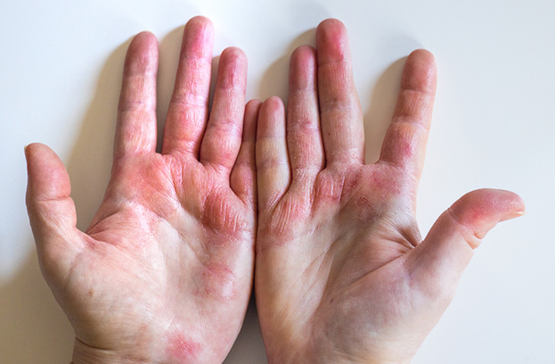 Skin.png сайтында капсаицин қанша уақытқа созылады