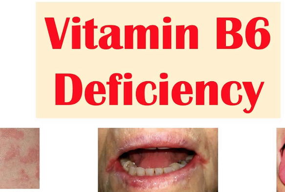 How much vitamin b6 to increase progesterone - Scigroundbio